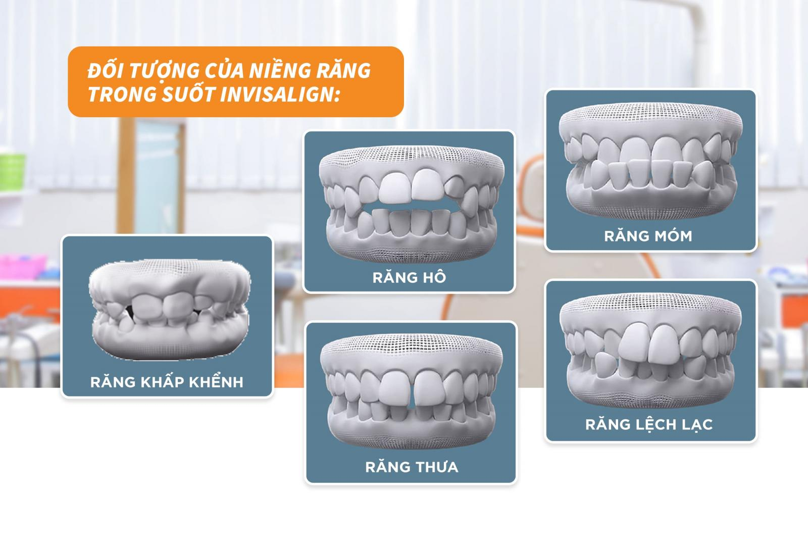 Niềng răng invisalign mang lại hiệu quả cho những đối tượng nào?